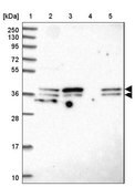 Anti-SUGT1 antibody produced in rabbit Prestige Antibodies&#174; Powered by Atlas Antibodies, affinity isolated antibody, buffered aqueous glycerol solution