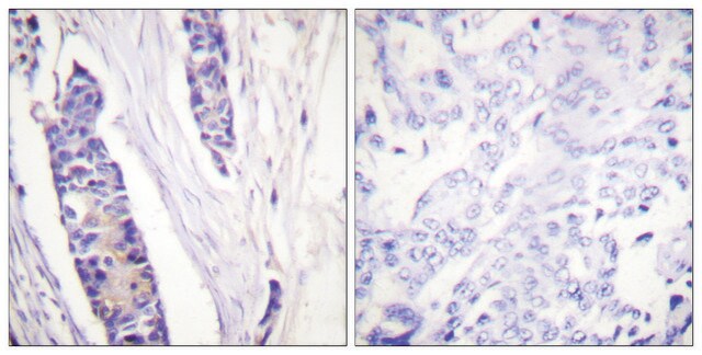 抗-微管蛋白 &#946; 兔抗 affinity isolated antibody