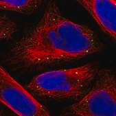 Anti-SFXN4 antibody produced in rabbit Prestige Antibodies® Powered by Atlas Antibodies, affinity isolated antibody, buffered aqueous glycerol solution