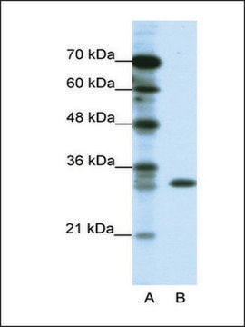Anti-TSFM (AB2) antibody produced in rabbit IgG fraction of antiserum