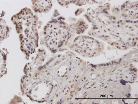 Anti-RP13-122B23.3 antibody produced in mouse purified immunoglobulin, buffered aqueous solution