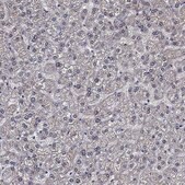 Anti-CLIP3 antibody produced in rabbit Prestige Antibodies&#174; Powered by Atlas Antibodies, affinity isolated antibody, buffered aqueous glycerol solution