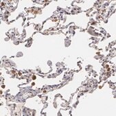 Anti-ZBTB16 antibody produced in rabbit Prestige Antibodies&#174; Powered by Atlas Antibodies, affinity isolated antibody, buffered aqueous glycerol solution