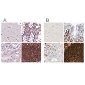 Anti-ARHGAP25 antibody produced in rabbit Prestige Antibodies® Powered by Atlas Antibodies, affinity isolated antibody