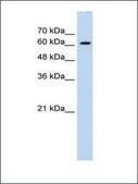 抗-ZIC2 兔抗 affinity isolated antibody