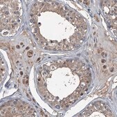 Anti-NAA60 antibody produced in rabbit Prestige Antibodies® Powered by Atlas Antibodies, affinity isolated antibody, buffered aqueous glycerol solution