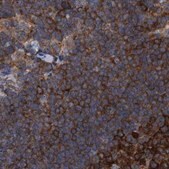 Anti-CDV3 antibody produced in rabbit Prestige Antibodies&#174; Powered by Atlas Antibodies, affinity isolated antibody, buffered aqueous glycerol solution, ab1