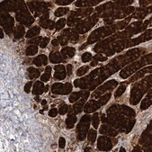 Anti-C2CD2 antibody produced in rabbit Prestige Antibodies&#174; Powered by Atlas Antibodies, affinity isolated antibody, buffered aqueous glycerol solution
