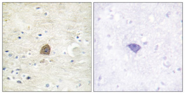 Anti-phospho-CaMK2&#945;/&#946;/&#948; (pThr305) antibody produced in rabbit affinity isolated antibody