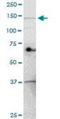 Monoclonal Anti-UBE4A antibody produced in mouse clone 1G8, purified immunoglobulin, buffered aqueous solution