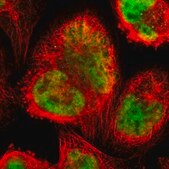 Anti-ZSCAN31 antibody produced in rabbit Prestige Antibodies® Powered by Atlas Antibodies, affinity isolated antibody, buffered aqueous glycerol solution