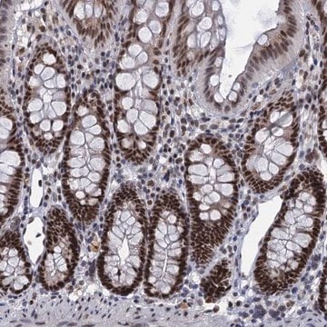 Anti-RPRD1A antibody produced in rabbit Prestige Antibodies&#174; Powered by Atlas Antibodies, affinity isolated antibody, buffered aqueous glycerol solution