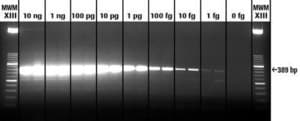 Transcriptor 一步法 RT-PCR 试剂盒 sufficient for 50&#160;reactions, sufficient for 150&#160;reactions, suitable for RT-qPCR, suitable for RT-PCR, hotstart