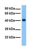 Anti-CYTB antibody produced in rabbit affinity isolated antibody
