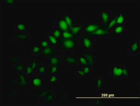 Anti-TRIM39 antibody produced in mouse purified immunoglobulin, buffered aqueous solution