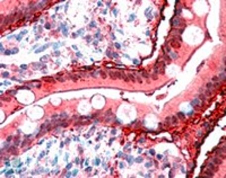 Anti-FABP2 antibody produced in goat affinity isolated antibody, buffered aqueous solution
