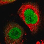 ANTI-RRP7A antibody produced in rabbit Prestige Antibodies&#174; Powered by Atlas Antibodies, affinity isolated antibody, buffered aqueous glycerol solution