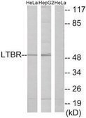 Anti-LTBR antibody produced in rabbit affinity isolated antibody