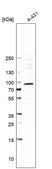 Anti-SFMBT1 antibody produced in rabbit Prestige Antibodies&#174; Powered by Atlas Antibodies, affinity isolated antibody