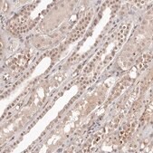 Anti-GLTSCR1L antibody produced in rabbit Prestige Antibodies® Powered by Atlas Antibodies, affinity isolated antibody, buffered aqueous glycerol solution, ab2