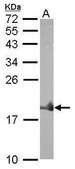 Anti-NPPA antibody produced in rabbit affinity isolated antibody, buffered aqueous solution