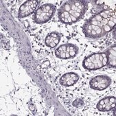 Anti-FCAMR Prestige Antibodies&#174; Powered by Atlas Antibodies, affinity isolated antibody