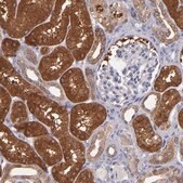Anti-PAPPA antibody produced in rabbit Prestige Antibodies&#174; Powered by Atlas Antibodies, affinity isolated antibody, buffered aqueous glycerol solution