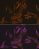 Anti-KIFAP3 Antibody, clone 1S7J7, Rabbit Monoclonal