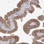 ANTI-DEPTOR antibody produced in rabbit Prestige Antibodies® Powered by Atlas Antibodies, affinity isolated antibody, buffered aqueous glycerol solution, Ab3