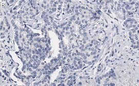 Anti-53BP1 Antibody, clone BP13 ZooMAb® Mouse Monoclonal recombinant, expressed in HEK 293 cells