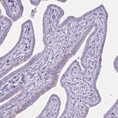 抗-GSDMB 兔抗 Prestige Antibodies&#174; Powered by Atlas Antibodies, affinity isolated antibody, buffered aqueous glycerol solution