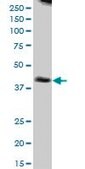 Anti-NUDT9 antibody produced in mouse purified immunoglobulin, buffered aqueous solution