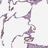 抗SFTPD 兔抗 Prestige Antibodies&#174; Powered by Atlas Antibodies, affinity isolated antibody, buffered aqueous glycerol solution
