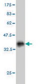 Monoclonal Anti-HOXD11, (N-terminal) antibody produced in mouse clone 6C8, purified immunoglobulin, buffered aqueous solution