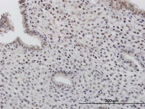Anti-TOB1 antibody produced in mouse purified immunoglobulin, buffered aqueous solution