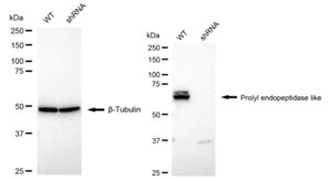 KD-Validated Anti Prolyl Endopeptidase Like Antibody, clone 24GB990, Rabbit Monoclonal clone 24GB990, recombinant rabbit monoclonal, expressed in HEK293 cells