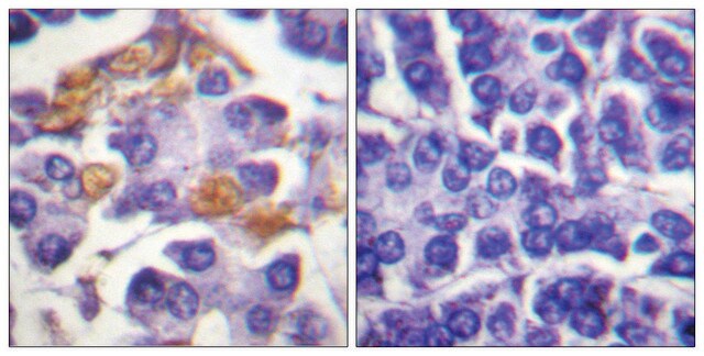 Anti-phospho-C-RAF (pTyr341) antibody produced in rabbit affinity isolated antibody