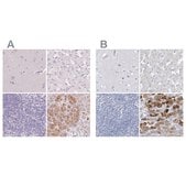 Anti-CTRL antibody produced in rabbit Prestige Antibodies® Powered by Atlas Antibodies, affinity isolated antibody, buffered aqueous glycerol solution