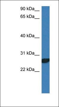 Anti-NDFIP2 antibody produced in rabbit affinity isolated antibody