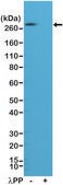 Anti-Phospho Acetyl CoA Carboxylase (Ser79) antibody, Rabbit monoclonal recombinant, expressed in HEK 293 cells, clone RM270, purified immunoglobulin