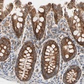 Anti-TBC1D10A antibody produced in rabbit Prestige Antibodies&#174; Powered by Atlas Antibodies, affinity isolated antibody, buffered aqueous glycerol solution