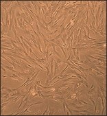 Porcine Pulmonary Artery Smooth Muscle Cells: PPASMC (Cryovial)