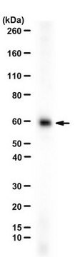 Anti-Oxytocin Receptor from rabbit, purified by affinity chromatography