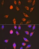 Anti-LGR6 Antibody, clone 8J2J10, Rabbit Monoclonal