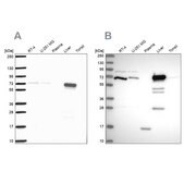 Anti-PCK2 antibody produced in rabbit Prestige Antibodies&#174; Powered by Atlas Antibodies, affinity isolated antibody, buffered aqueous glycerol solution