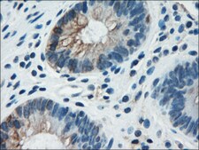 Monoclonal Anti-CK18 antibody produced in mouse clone 10, purified immunoglobulin, buffered aqueous glycerol solution