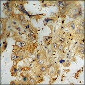 Anti-phospho-ATF2 (pSer62 or 44) antibody produced in rabbit affinity isolated antibody