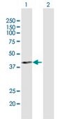 Anti-PCID2 antibody produced in rabbit purified immunoglobulin, buffered aqueous solution