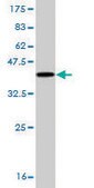 Monoclonal Anti-CAMK2A antibody produced in mouse clone 2C12, purified immunoglobulin, buffered aqueous solution