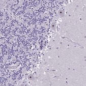 Anti-NOC2L antibody produced in rabbit Prestige Antibodies&#174; Powered by Atlas Antibodies, affinity isolated antibody, buffered aqueous glycerol solution